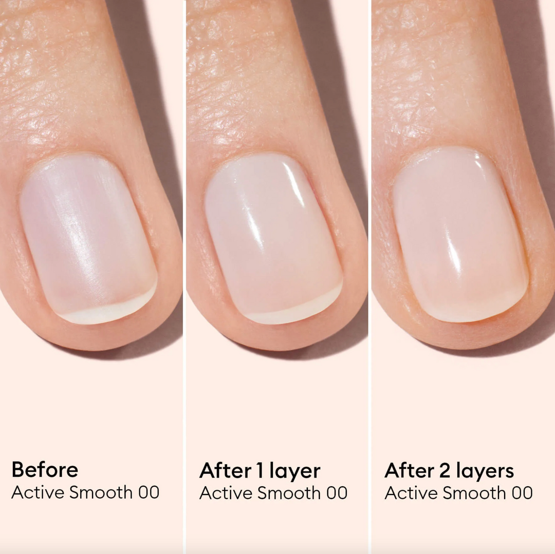 Active™ Smooth Ridge Filler