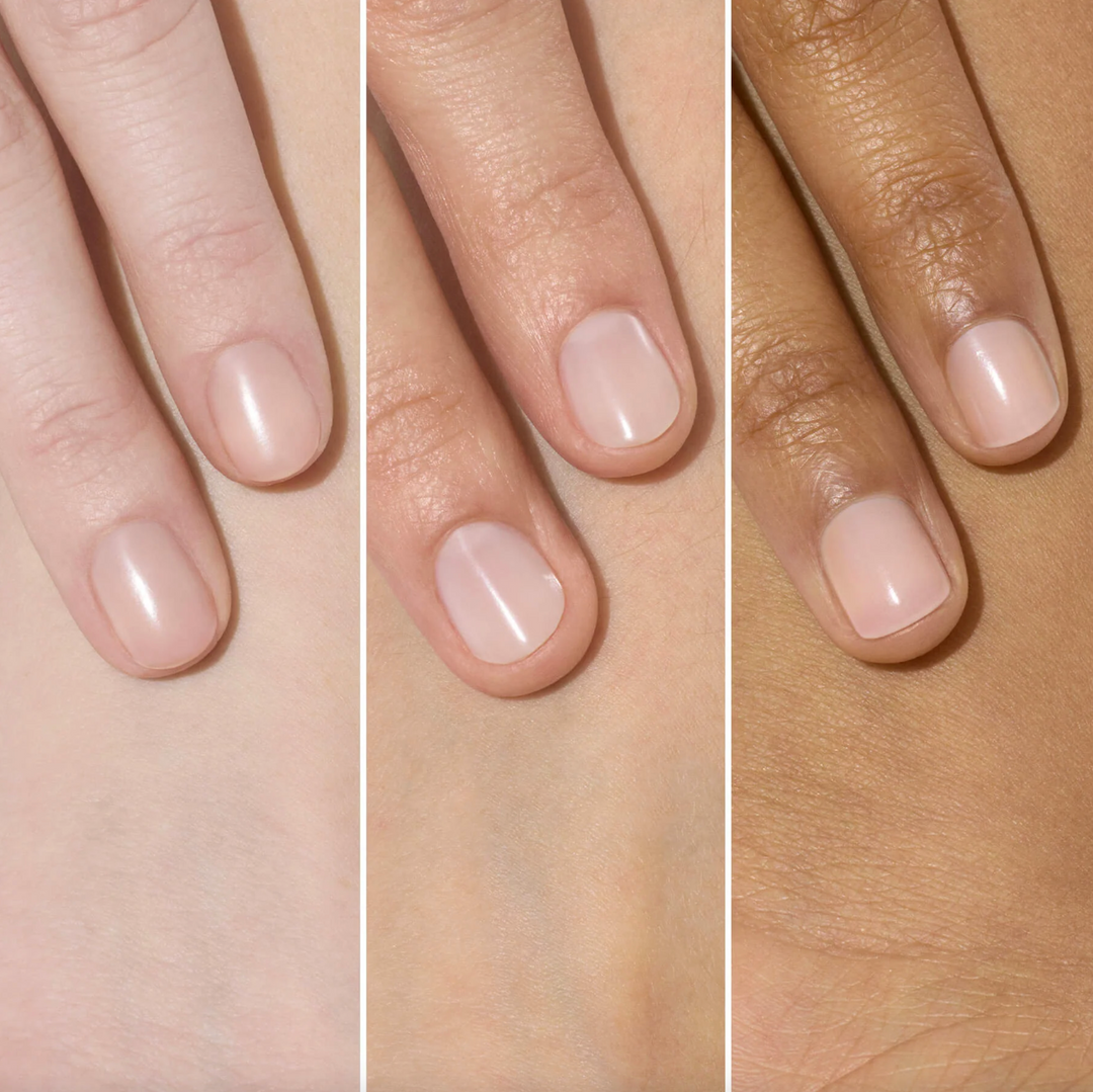 Active™ Smooth Ridge Filler