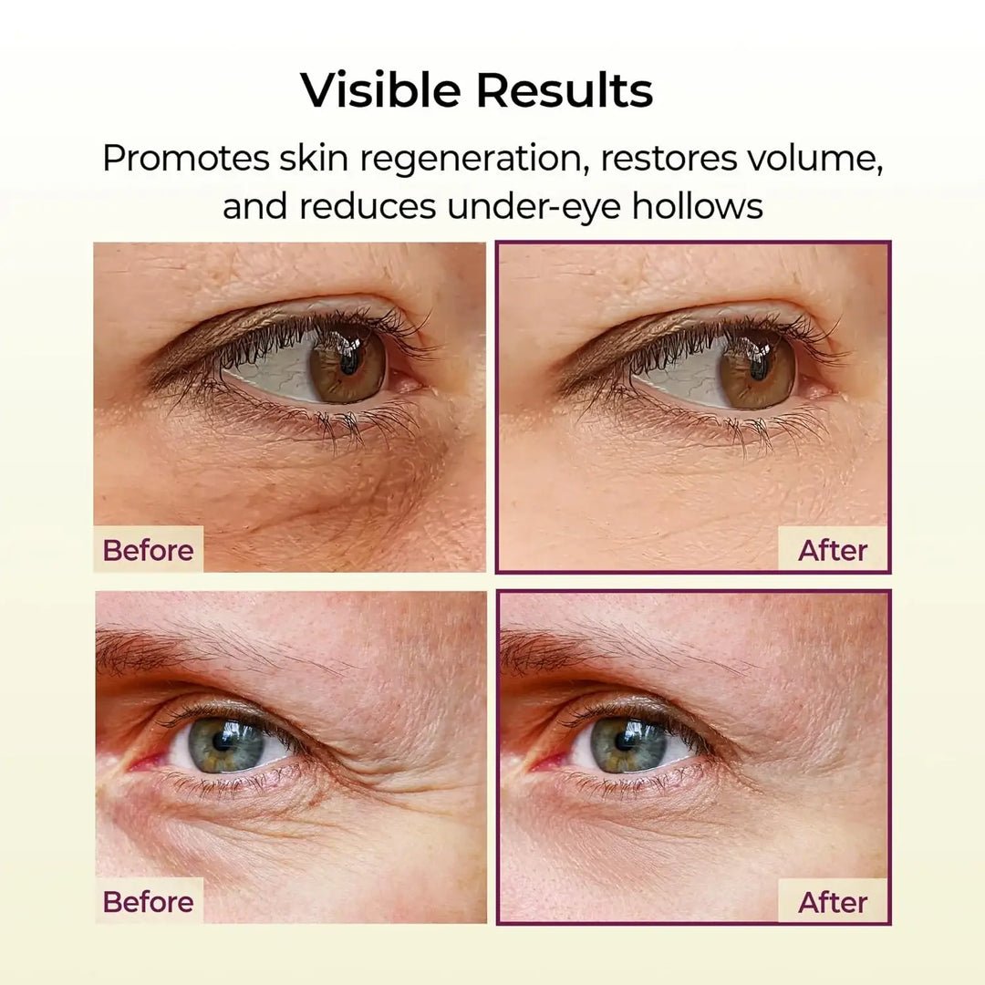 Cemenrete Calcium Volume Multi Balm 