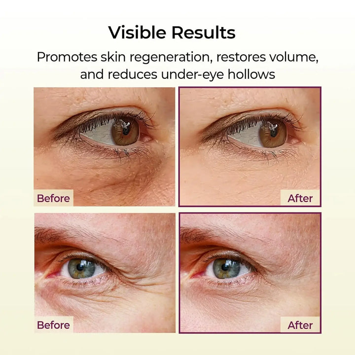 Cemenrete Calcium Volume Multi Balm 
